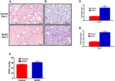 The Selective Angiotensin II Type 2 Receptor Agonist, Compound 21, Attenuates the Progression of Lung Fibrosis and Pulmonary Hypertension in an Experimental Model of Bleomycin-Induced Lung Injury